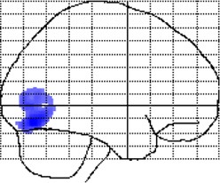 graphic file with name fpsyg-05-01551-i0007.jpg